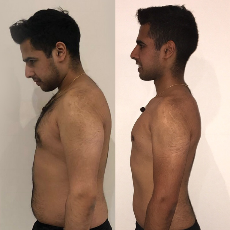 Akash body transformation: before and after